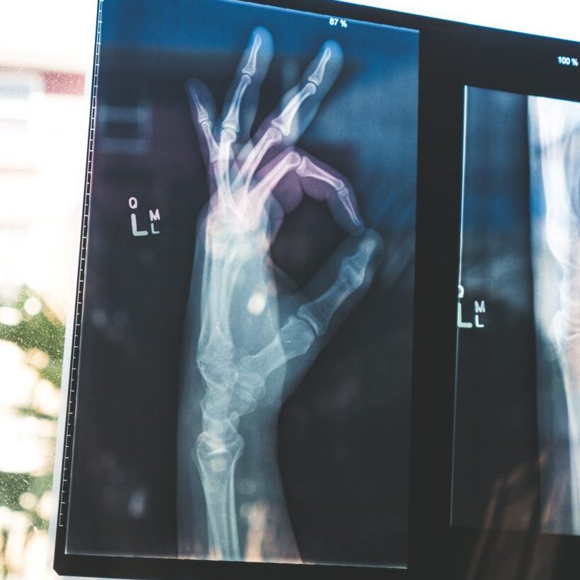 Daten in der Radiologie